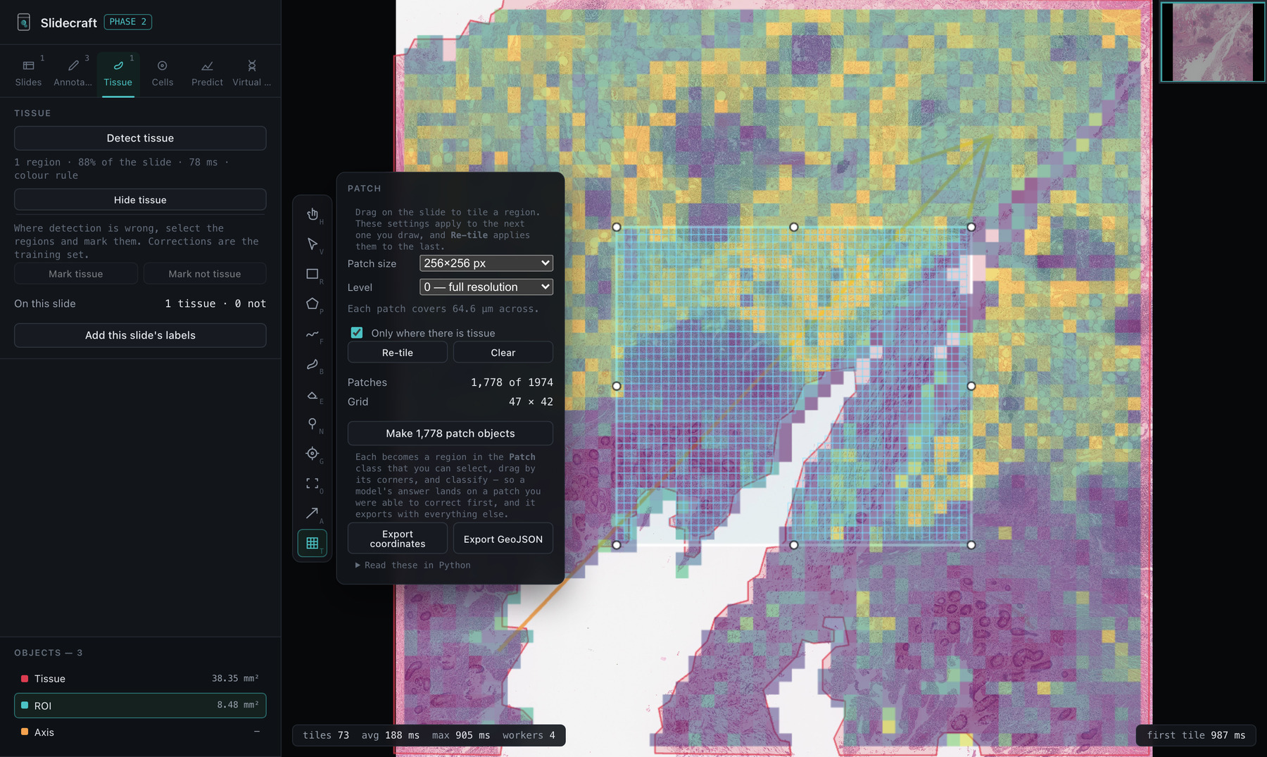 The patch tool tiling a dragged region, restricted to detected tissue