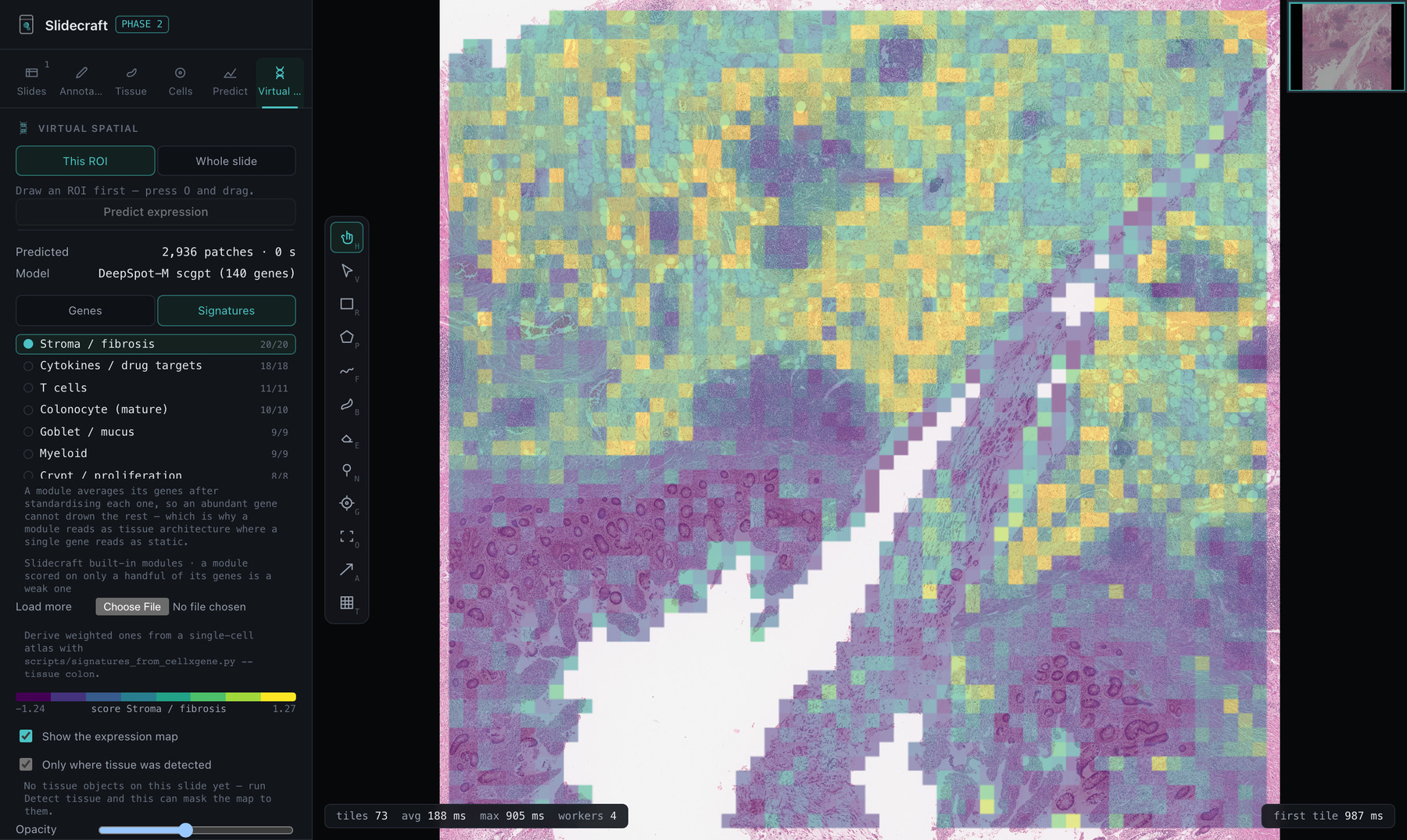 The same tissue read as a stromal module, the inverse of the goblet map